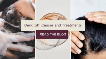 DANDRUFF: CAUSES & TREATMENTS